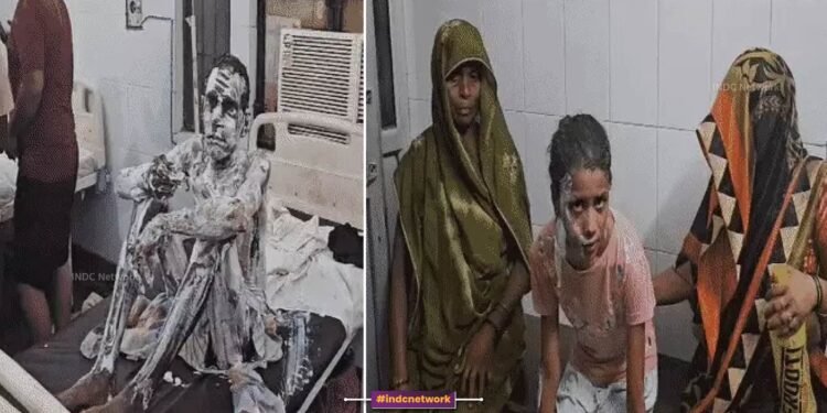 आगरा में गैस सिलेंडर लीक से मचा कहर: एक ही परिवार के 14 लोग झुलसे