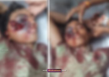 फर्रुखाबाद में 17 वर्षीय अमलेश शाक्य को सिर में मारी गोली, हालत नाजुक, सैफई रेफर