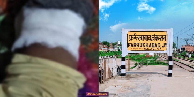 सड़क निर्माण के बीच मासूम की गंभीर हालत, FIR की डिटेल्स खोलती कई चौंकाने वाली बातें